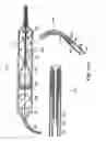 Fig. 20 - Method and devices for minimally invasive arthroscopic procedures
