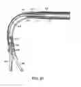 Fig. 24 - Method and devices for minimally invasive arthroscopic procedures