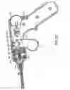 Fig. 27 - Method and devices for minimally invasive arthroscopic procedures