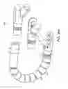 Fig. 29 - Method and devices for minimally invasive arthroscopic procedures