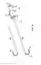 Fig. 33 - Method and devices for minimally invasive arthroscopic procedures