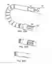 Fig. 34 - Method and devices for minimally invasive arthroscopic procedures