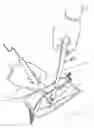 Fig. 01 - Suction retraction surgical instrument