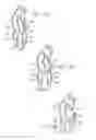 Fig. 03 - Device to permit offpump beating heart coronary bypass surgery
