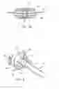 Fig. 08 - Device to permit offpump beating heart coronary bypass surgery