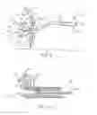 Fig. 09 - Device to permit offpump beating heart coronary bypass surgery