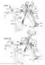 Fig. 02 - Retraction of the left atrial appendage