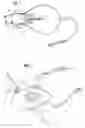 Fig. 02 - OPHTHALMIC SULCUS SPECULUM