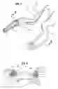 Fig. 05 - OPHTHALMIC SULCUS SPECULUM