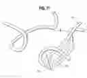 Fig. 07 - OPHTHALMIC SULCUS SPECULUM