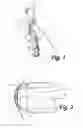 Fig. 02 - Medical probe with consistent action