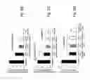 Fig. 08 - Method of recognizing abnormal tissue using the detection of early increase in microvascular blood content