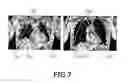 Fig. 04 - Elastic image registration