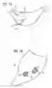 Fig. 04 - Mapping catheter as well as mapping catheter apparatus and associated method