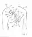 Fig. 02 - Methods of identifying and/or assessing cardiac arrhythmias using an implantable medical device