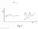 Fig. 07 - ECG signal power vector detection of ischemia or infarction
