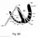 Fig. 10 - ECG signal power vector detection of ischemia or infarction