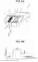 Fig. 05 - Multi-site body fluid sampling and analysis cartridge