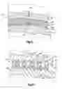Fig. 08 - Apparatus and method for assessing loads on adjacent bones