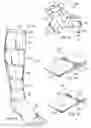 Fig. 02 - Compression garment