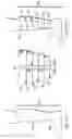 Fig. 11 - Compression garment