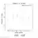 Fig. 10 - Wearable continuous renal replacement therapy device
