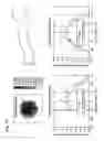 Fig. 16 - Illuminated infusion cannula