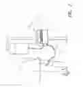 Fig. 02 - Analyte detection system with periodic sample draw and body fluid analyzer