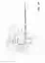 Fig. 61 - Analyte detection system with periodic sample draw and body fluid analyzer