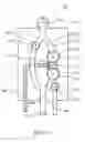 Fig. 12 - Method and apparatus for testing blood glucose in a reversible infusion line