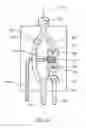 Fig. 15 - Method and apparatus for testing blood glucose in a reversible infusion line