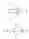 Fig. 04 - IRRIGATION DEVICE