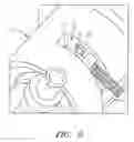 Fig. 09 - Systems and methods for locking and detecting the presence of a catheter