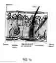Fig. 02 - Apparatuses and methods to treat biological external tissue