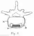 Fig. 07 - Magnetic spinal implant device