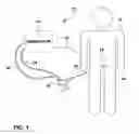 Fig. 02 - Flexible catheter for ablation therapy