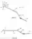 Fig. 06 - ELECTROSURGERY ELECTRODE