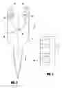 Fig. 03 - IMPLANT DEVICE INCLUDING THREADED LOCKING MECHANISM
