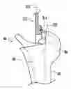 Fig. 01 - Hip stem centralizer datum guide, and method