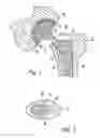 Fig. 02 - Hip stem centralizer datum guide, and method