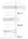 Fig. 02 - FISTULA GRAFT DEPLOYMENT SYSTEMS AND METHODS