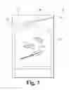Fig. 04 - FISTULA GRAFT DEPLOYMENT SYSTEMS AND METHODS