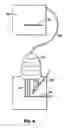 Fig. 04 - Hyperechoic stimulating block needle