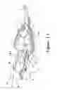 Fig. 02 - Suture retention device