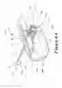 Fig. 12 - Suture retention device