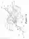 Fig. 14 - Suture retention device