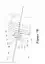 Fig. 15 - Suture retention device