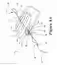 Fig. 16 - Suture retention device