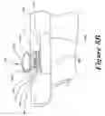 Fig. 17 - Suture retention device