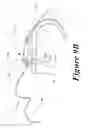 Fig. 19 - Suture retention device